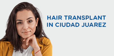 Hair transplant clinic in Ciudad Juarez